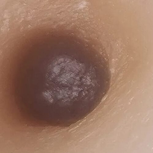 Derm'Esthe Dermopigmentation esthétique réparatrice Prothèse aréole mammaire mastectomie reconstruction silicone Aix-en-Provence Marseille Gemenos, Roquevaire Peypin La Bouilladisse Saint-Zacharie Gréasque Fuveau Peynier Trets Rousset Fuveau Chateauneuf-le-rouge Meyreuil Gardanne Mimet Auriol Gemenos